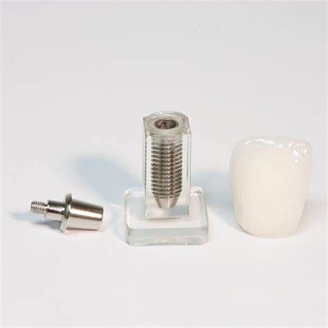 Incisor Implant Study Model