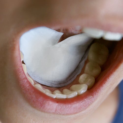 DryDent® Sublingual Unique saliva control