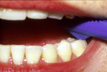 Tooth Slooth and Tooth Slooth II